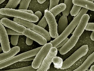 klebsiella_pneumoniae_urinary_tract_infection_2